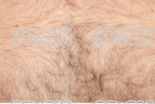 Skin texture of Koloman 0001